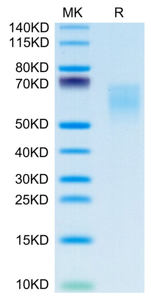 Recombinant Human B7-2/CD86 Protein (RPCB0650)