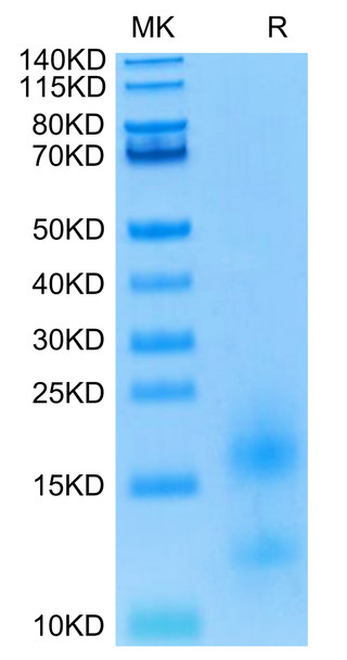Biotinylated Recombinant Human TNFRSF17/BCMA/CD269 Protein (RPCB0658)