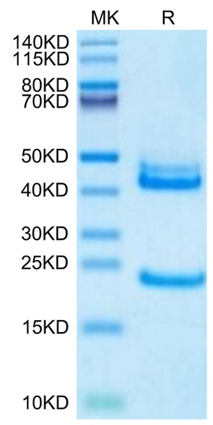 Biotinylated Recombinant Human IL-23/IL-12B&IL-23A Protein (RPCB0660)