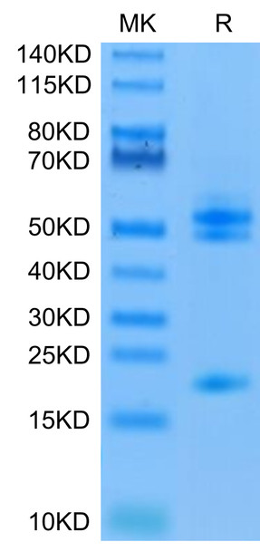 Recombinant Human IL-23A&Mouse IL-12B Protein (RPCB0661)