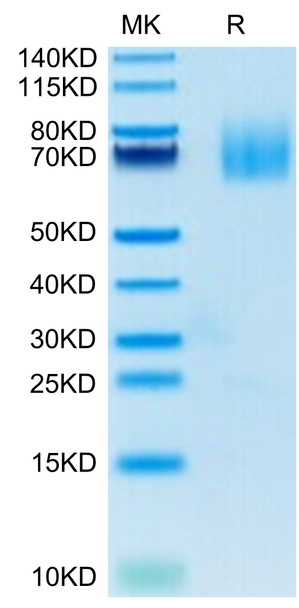 Recombinant Human TNFSF7/CD27 Ligand/CD70 Protein (RPCB0671)