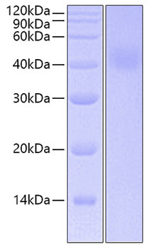 Recombinant Human IL-20RA Protein (RPCB0681)