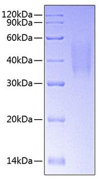 Recombinant Human TNFRSF10C/DcR1/TRAIL-R3/CD263 Protein (RPCB0707)