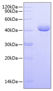 Recombinant Human Nectin-4/PVRL4 Protein (RPCB0708)
