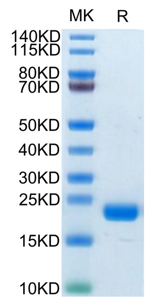 Biotinylated Recombinant Human MS4A1/CD20 Protein (RPCB0712)