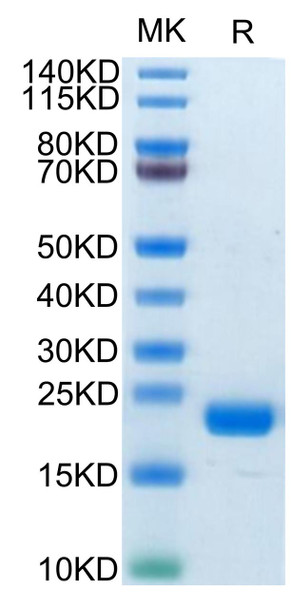 Biotinylated Recombinant Human MS4A1/CD20 Protein (RPCB0712)