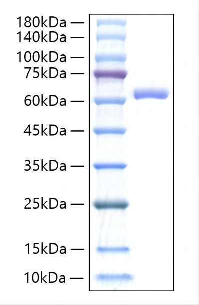 Recombinant Mouse IL-27/IL-27A&IL-27B Protein (RPCB0721)