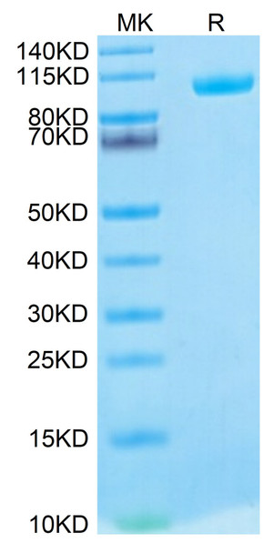 Biotinylated Recombinant Human MMP-9 Protein (RPCB0731)