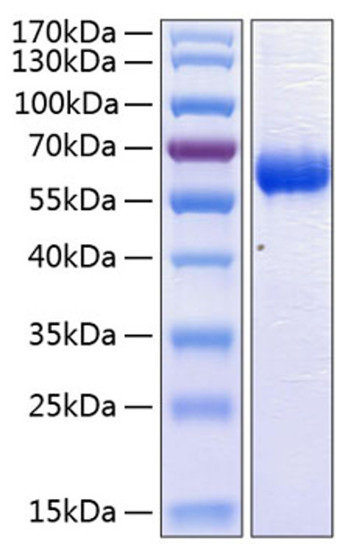 Recombinant Human CD47 Protein (RPCB0742)