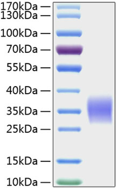 Recombinant Human Activin RIIA/ACVR2A Protein (RPCB0772)