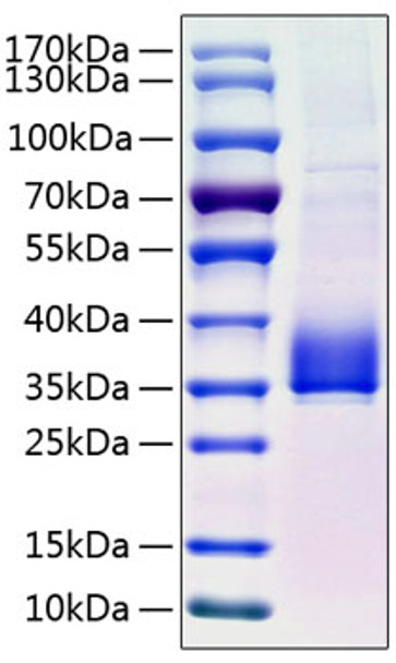 Recombinant Human Angiopoietin-like 3/ANGPTL3(17-220) Protein (RPCB0779)