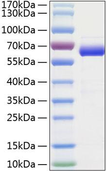 Recombinant Human Siglec-15/CD33L3 Protein (RPCB0796)