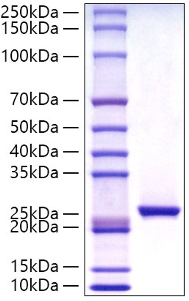 Recombinant Human C-Reactive Protein/CRP Protein (RPCB0817)