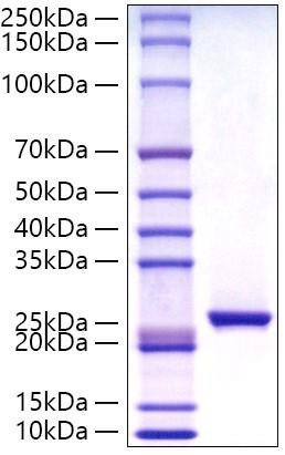 Recombinant Human C-Reactive Protein/CRP Protein (RPCB0817)