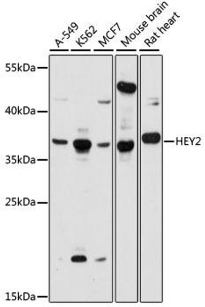 Anti-HEY2 Antibody (CAB15143)