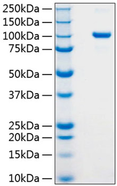 Recombinant Human Argonaute-2/AGO2 Protein (RPCB0825)