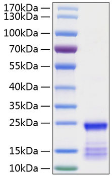 Recombinant Human GTPase KRas/KRAS Protein (RPCB0827)