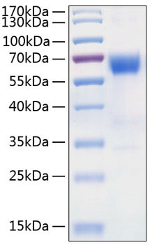 Recombinant Human TNFRSF10D/DcR2/TRAIL-R4/CD264 Protein (RPCB0843)
