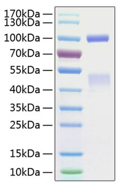 Recombinant Human HGF receptor/c-MET/MET Protein (RPCB0852)