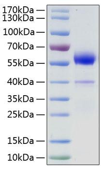 Recombinant Human VEGF-B/VEGF186 Protein (RPCB0866)