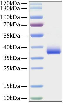 Recombinant SARS-COV-2 Spike RBD(E484K) Protein (RPCB0880)