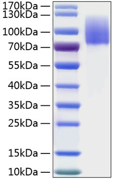 Recombinant Human MERTK Protein (RPCB0887)