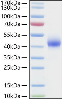 Recombinant Human Dkk-1 Protein (RPCB0891)