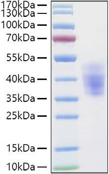 Recombinant Human NKAT-2/KIR2DL3/CD158b2 Protein (RPCB0905)