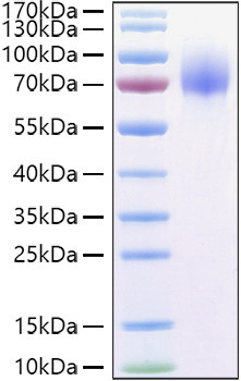Recombinant Human Osteoactivin/GPNMB Protein (RPCB0917)