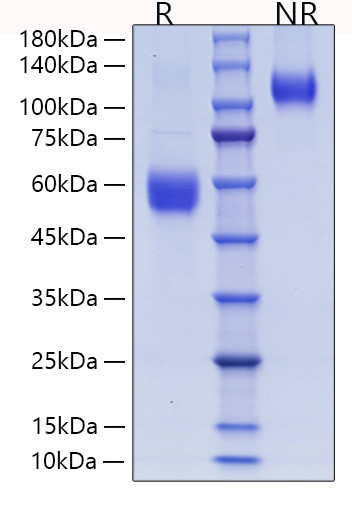 Recombinant Human ICOS/CD278 Protein (RPCB0920)