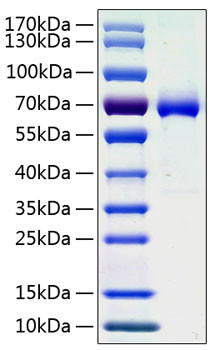 Recombinant Human Ephrin-A3/EFNA3 Protein (RPCB0922)