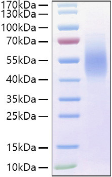 Recombinant Human MUC-16/CA125 Protein (RPCB0928)