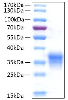 Recombinant Human IFN-lambda 1/IL-29 Protein (RPCB0934)