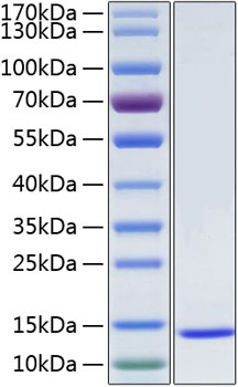 Recombinant Human Serum amyloid A-1/SAA1 Protein (RPCB0963)