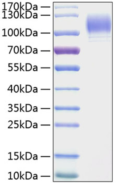 Recombinant Mouse P-Selectin/SELP/CD62P Protein (RPCB0967)