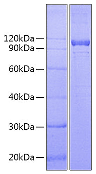 Recombinant Human IL-12 R beta 1/CD212 Protein (RPCB0972)