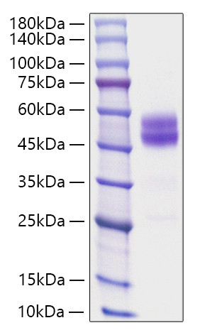 Recombinant Mouse TIGIT Protein (RPCB0981)