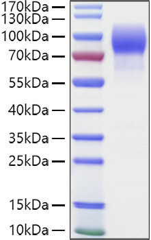 Recombinant Human MUC-16/CA125 Protein (RPCB1017)