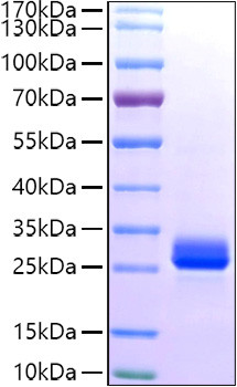 Recombinant Human GSTA1 Protein (RPCB1039)