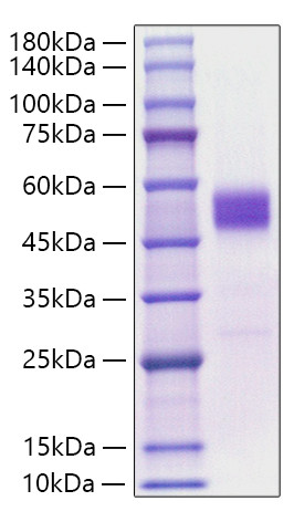Recombinant Mouse TIGIT Protein (RPCB1049)