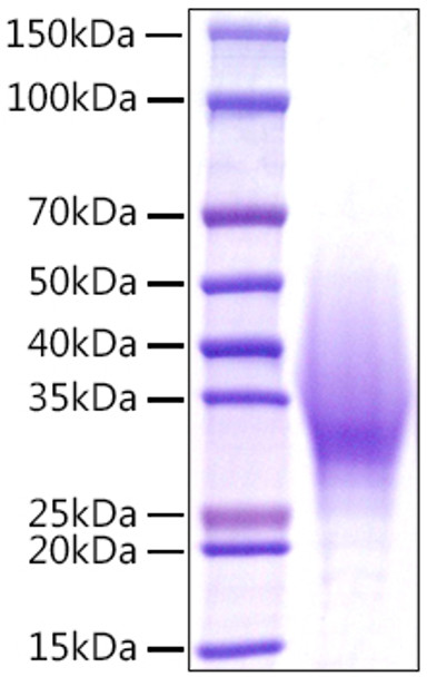 Recombinant Mouse IL-18BP Protein (RPCB1067)