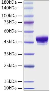 Recombinant Mouse TNFRSF9/4-1BB/CD137 Protein (RPCB1068)
