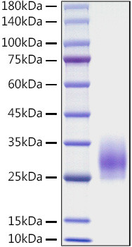 Recombinant Mouse CD83 Protein (RPCB1074)
