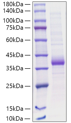 Recombinant Human Carbonic anhydrase 5A/CA5A Protein (RPCB1091)