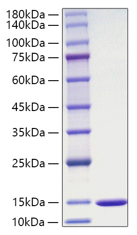 Recombinant Mouse Macrophage migration inhibitory factor/MIF Protein (RPCB1105)