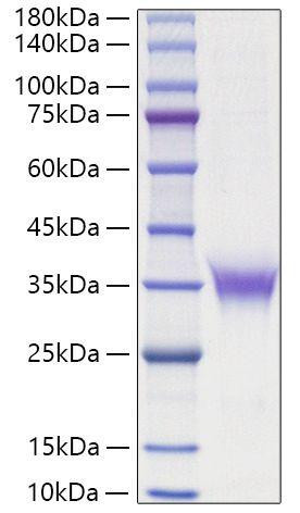 Recombinant Rat Erythropoietin/EPO Protein (RPCB1115)