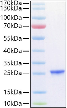 Recombinant Human TIMP-2 Protein (RPCB1127)