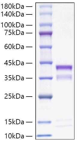 Recombinant Mouse Cathepsin S/CTSS Protein (RPCB1133)
