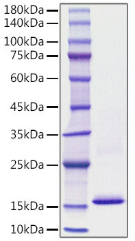 Recombinant Human S100-A8 Protein (RPCB1141)
