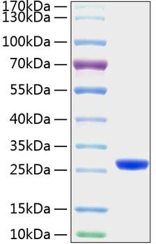 Recombinant Mouse Lipocalin-2/NGAL/LCN2 Protein (RPCB1149)
